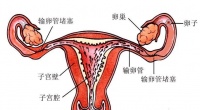 备孕迟迟不成功？四维输卵管超声造影带来好“孕”新希望！