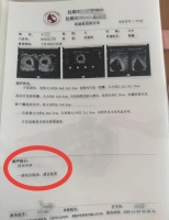 原创             奇闻！30 岁宝妈每次产检都多一胎，最终确诊同卵四胞胎！