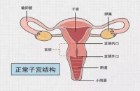 输卵管造影：精准排查输卵管问题，开启好孕之路