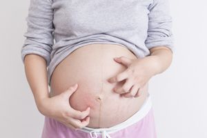 孕妇多吃水果宝宝皮肤会好吗