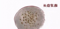 原创 宝宝头皮乳痂,这才是正确的处理方法!别像这位妈妈一样太无知了