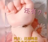 原创 “米其林”宝宝走红,用肉肉夹苍蝇,宝妈笑哭:天生就是捕蝇神器
