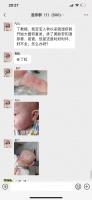宝宝入秋以来湿疹就开始大面积爆发,应该如何改善?