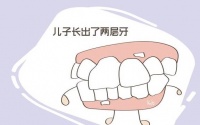 原创 宝宝上牙怎么长出了“两层”?原来妈妈有责任,只是大家都不知道