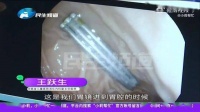 心疼!1岁婴儿胃里竟然有3根6cm钢钉...
