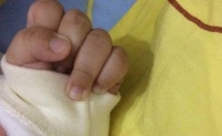 原创 六个月的婴儿紧握拳头,奶奶发现不对劲带去医院检查,医生:晚了