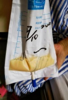 27岁小伙身体每天流出乳状液体,竟是这里漏了!