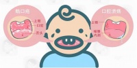 天使指南:鹅口疮到底是什么?如何预防和治疗?