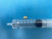 揪心!青岛1岁孩子紧急送医,“元凶”竟是生活中常见的……