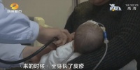 家长这一举动,百天宝宝全身红疹,医生:无科学依据!