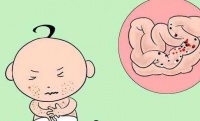 原创 宝宝能长期吃益生菌吗?或许答案和你想的不一样