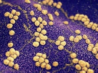 【葡萄球菌性烫伤样皮肤综合征】没有什么比看到孩子的笑容更幸福