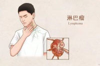 「淋巴瘤一」腹痛3天危及生命,2岁5个月的小宝竟得了恶性淋巴瘤