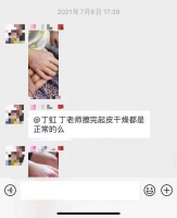 宝宝湿疹家长急,莫慌张治疗需要时间