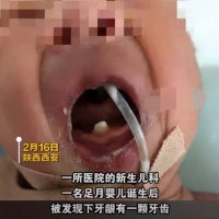 原创 罕见!足月婴儿娘胎里长了1颗牙,医生:宝宝牙齿生长规律了解下