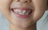 原创 不吃糖果就能预防蛀牙?错了!这几点才可以