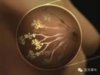 当哺乳期遇上乳腺炎!