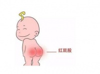 宝宝红屁屁是怎么造成的呢?