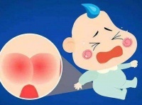 宝宝红屁屁应该怎么护理?