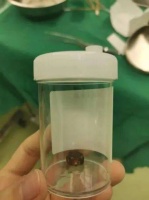家长注意!4岁女童突然莫名流鼻血不止,原因竟是…
