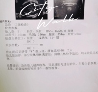 【孕期指南】一个公式教你用B超数据测胎儿体重