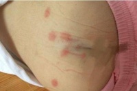 原创             女儿总说屁屁痒，到医院检查，医生的话让宝妈汗毛都竖起来了