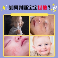 宝宝经常过敏,记住这几个部位就能判断宝宝是否过敏!