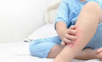 原创 小孩身上若出现“这3个迹象”,或说明床上螨虫藏匿,尽量别忽略