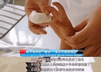 原创 宝宝指甲有这4种症状是患病信号!尤其第1种,不及时治可能癌变