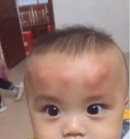 夏季驱蚊作战,哈丁宝贝让你不受蚊虫困扰