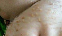 原创 出生3天的新生宝宝突然哭闹不停,宝妈掀开被子一看,瞬间崩溃…