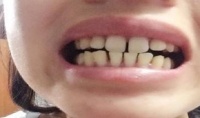 原创 孩子的牙缝越来越大,担心影响颜值,其实这很可能是好事