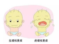 广东:孩子出生后全身皮肤、黏膜发黄,一查竟是这病,严重可致命!