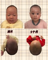 舟状头?太阳穴凹陷?睡好头型实现颜值逆袭