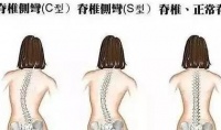 原创 4个月宝宝被查出“脊柱变形”,只因妈妈这样做,导致这一切
