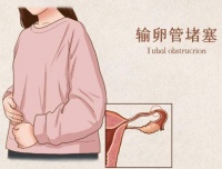 输卵管堵塞是造成不孕的主要原因之一，它都有哪些症状表现？
