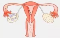 女性不孕卵子少可以做试管婴儿生宝宝吗?