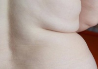 肥胖竟也会导致不孕?想要有“好消息”,得先学会控制体重