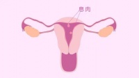 久备不孕,千万别忽视求子路上的这个“拦路虎”!