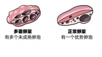 多年不孕差点去领养孩子，通过中药调理不久就怀孕了