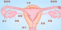 原创             输卵管通畅为什么不怀孕