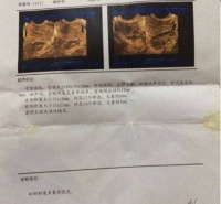 暂时的不孕不必惊慌，保持信心，找对合适的人调理就能解决
