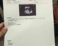 多亏了中医的调理,帮助她顺利解决了多年的不孕