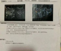 结婚多年不孕,后悔知道中医晚了,幸亏还是被调理好了
