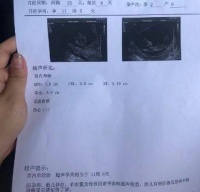 通过朋友介绍,她过来找我们调理好了不孕