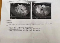 你身边有不孕的女性朋友吗?她们是怎么调理好的