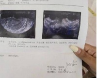 结婚后多年不孕,求子之路很坎坷,通过中医调理终于怀孕了