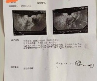 备孕许久始终不孕,中医调理后顺利怀孕