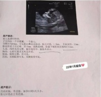 结婚后多年不孕,夫妻经常由此吵架,中医调理助孕成功