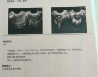 中医调理女性不孕,助您好“孕”降临